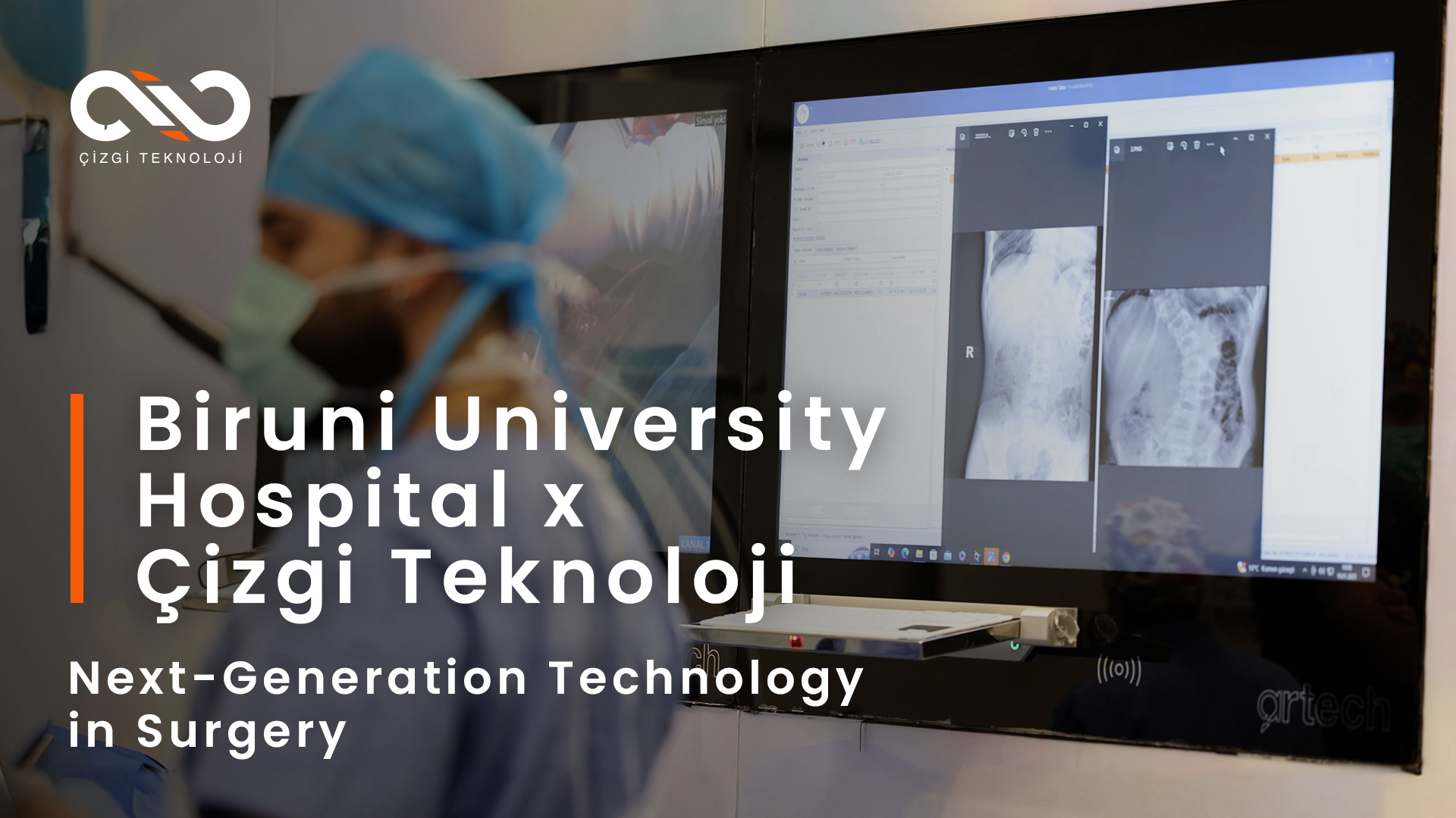 Biruni University Hospital x Çizgi Teknoloji | Next-Generation Technology in Surgery